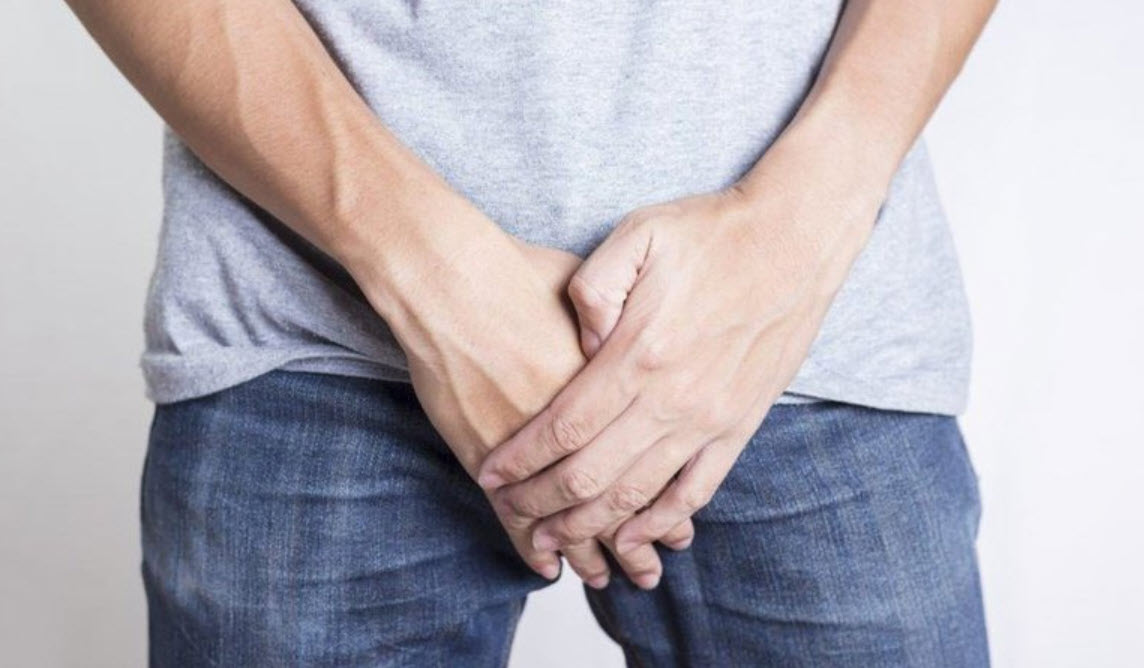 Biểu hiện vết loét sinh dục điển hình do bệnh hạ cam mềm ở nam giới có đặc điểm mềm, đau và dễ chảy mủ.