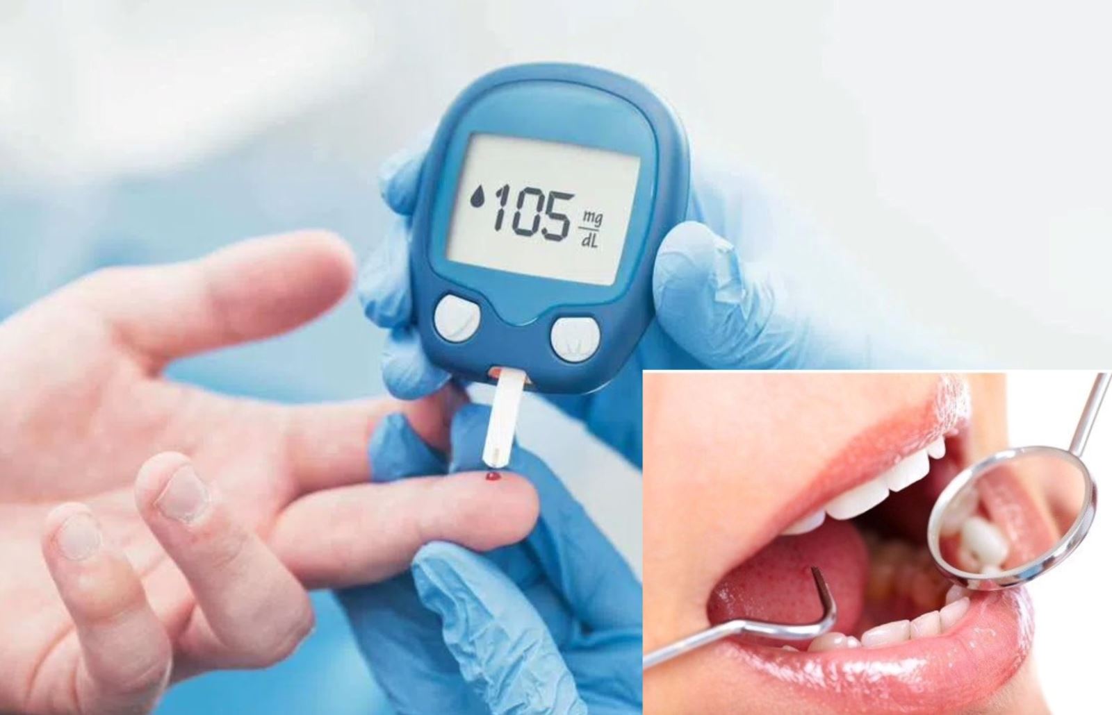 Khi lượng đường trong máu không được kiểm soát tốt, các biến chứng răng miệng như sâu răng, khô miệng, viêm lợi, viêm nha chu… có thể xuất hiện.
