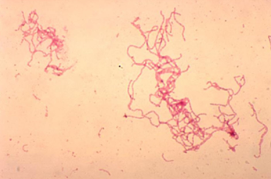 Vi khuẩn Haemophilus ducreyi dưới kính hiển vi – tác nhân chính gây bệnh hạ cam mềm.