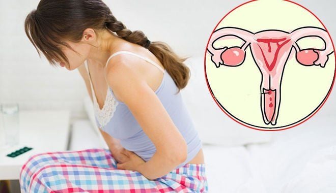 Ung thư cổ tử cung là một trong những loại ung thư phổ biến nhất ở phụ nữ trên toàn cầu.