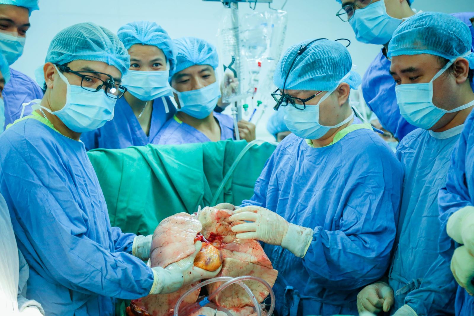 Khối tim - phổi của người hiến được chuẩn bị đưa vào ghép cho bệnh nhân.