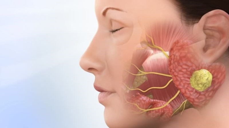 Cơn đau có thể khởi phát tự nhiên hoặc do kích thích như: nói, nhai, rửa mặt bằng nước lạnh...
