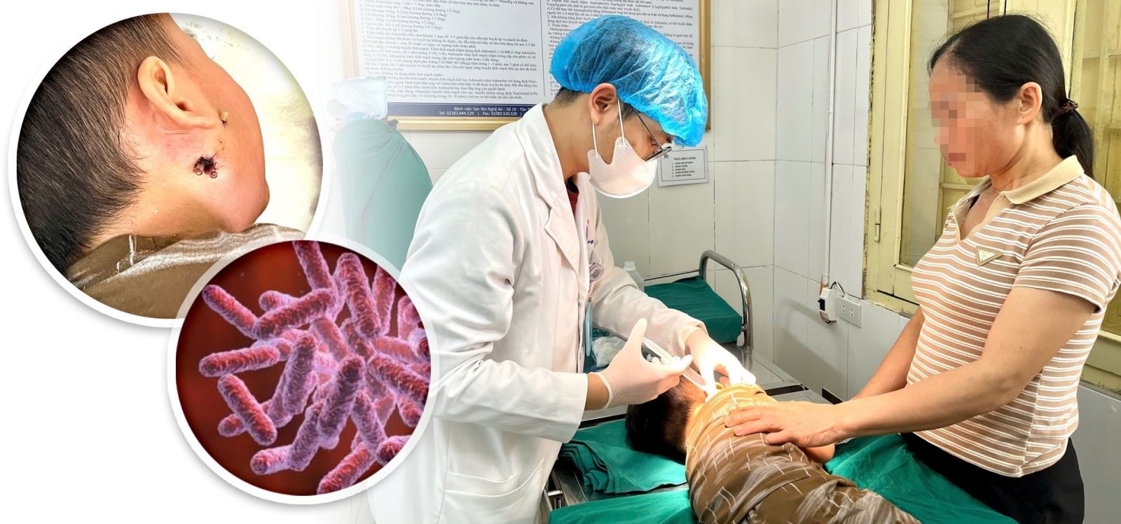 Cứu chữa thành công ca bệnh Whitmore nguy hiểm ở trẻ nhỏ.