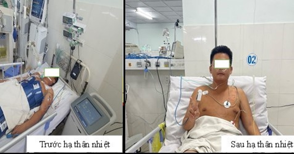 Một bệnh nhân nguy kịch đã có sự thay đổi rõ rệt trước và sau khi được áp dụng kỹ thuật hạ thân nhiệt chỉ huy.