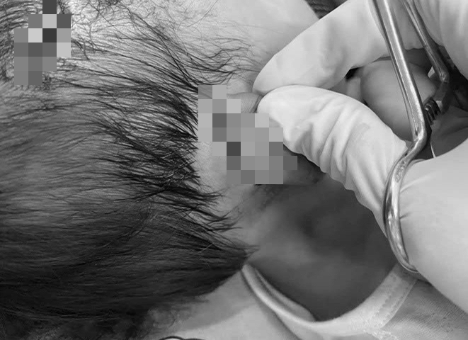 Cháu bé bị chó dữ tấn công với nhiều vết thương.