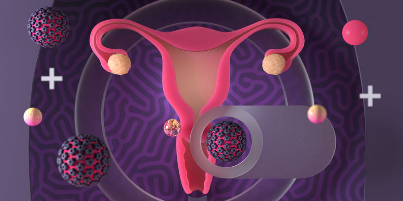 Virus HPV là nguyên nhân chính gây ung thư cổ tử cung.