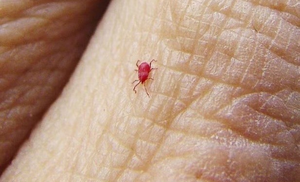 Hình ảnh con mò trên da người.