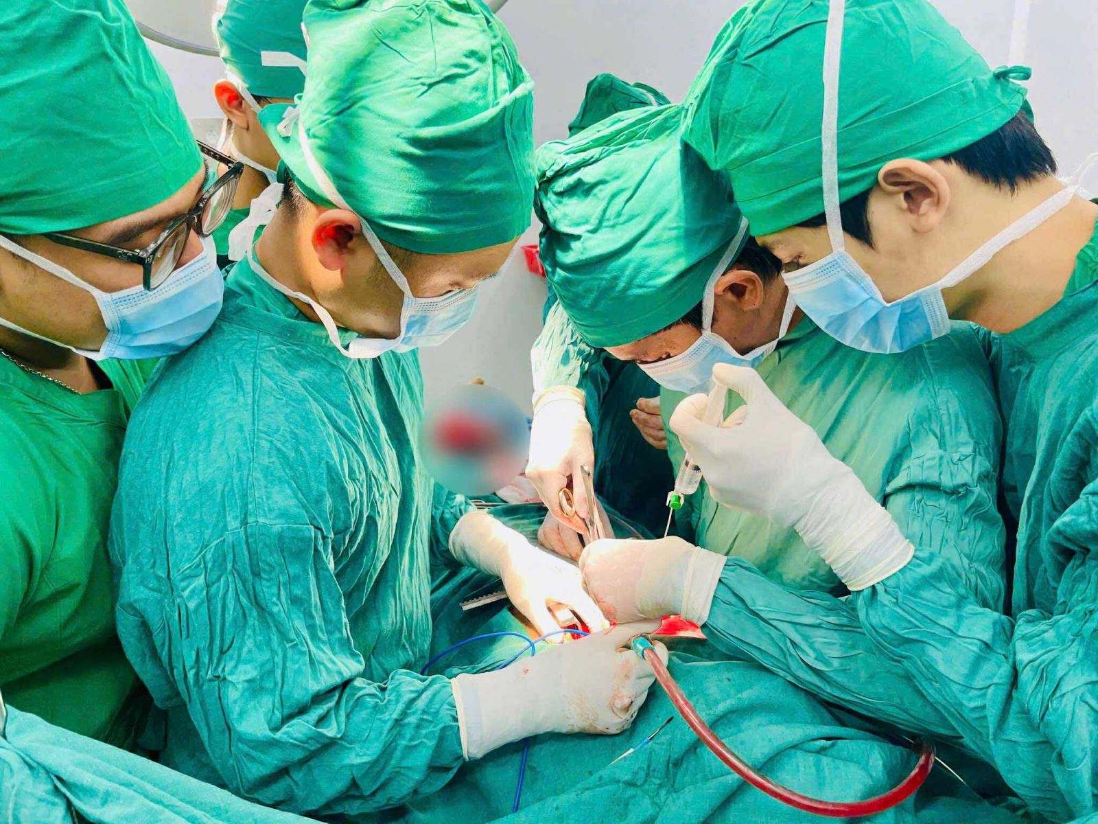 Các bác sĩ thực hiện ca phẫu thuật cho bệnh nhân bị vỡ tim.