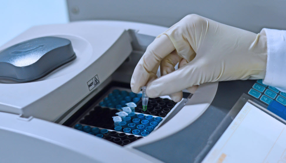 Phân tích mẫu DNA để xác định biến thể CFAP65 liên quan vô sinh nam.