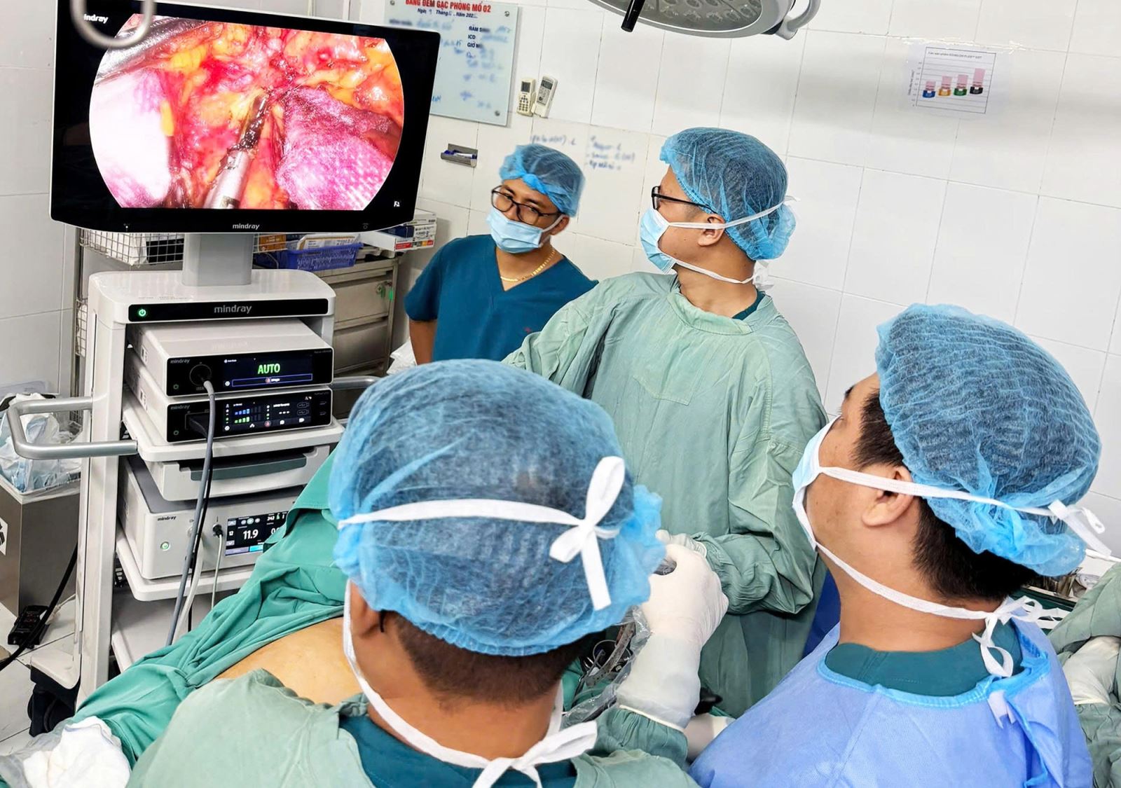 Ê-kíp bác sĩ phẫu thuật cắt bỏ khối u cho bệnh nhân. 