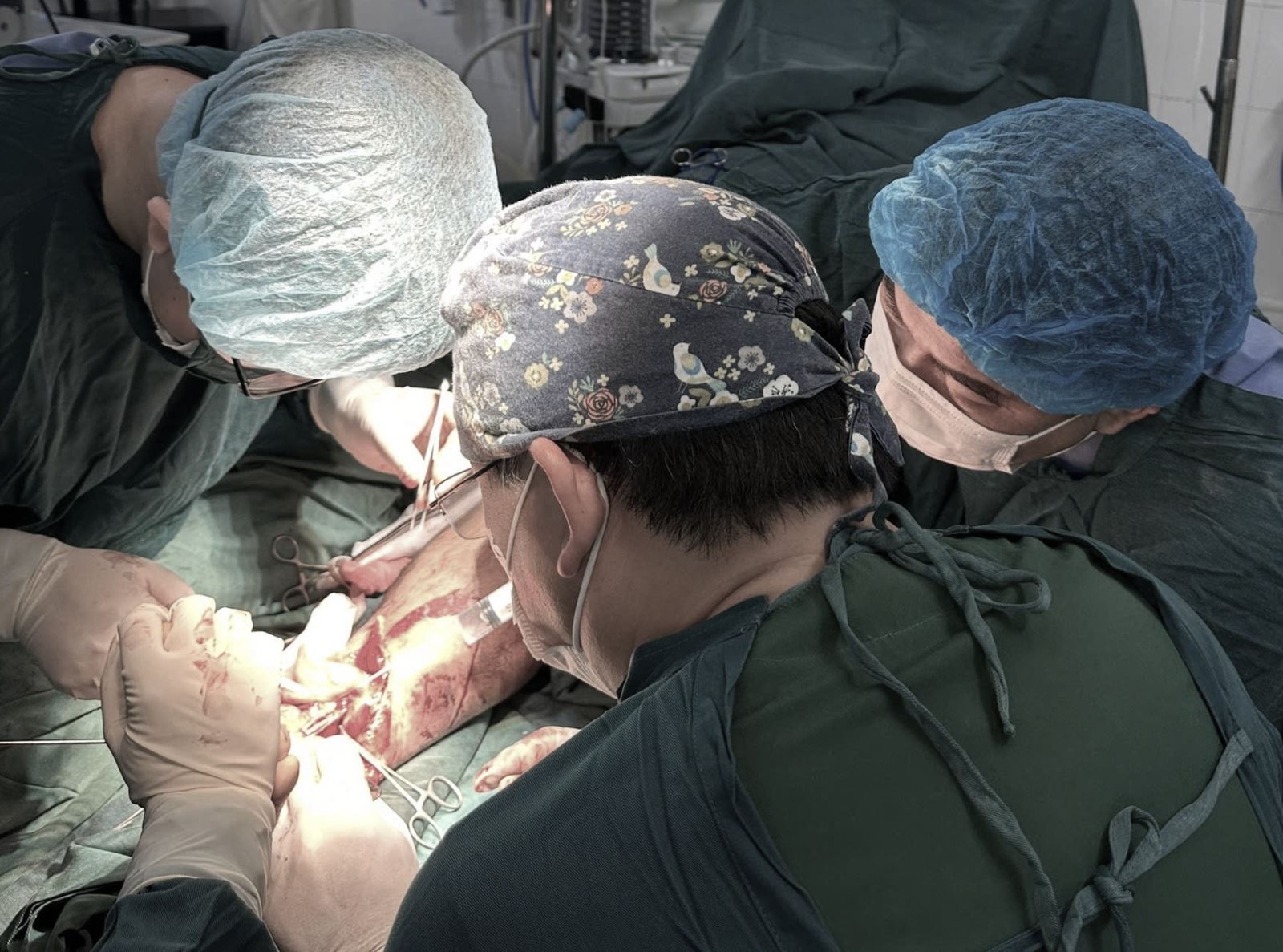 Sau 4 giờ phẫu thuật, ca nối chân trái đã hoàn thành, đầu chi hồng ấm.