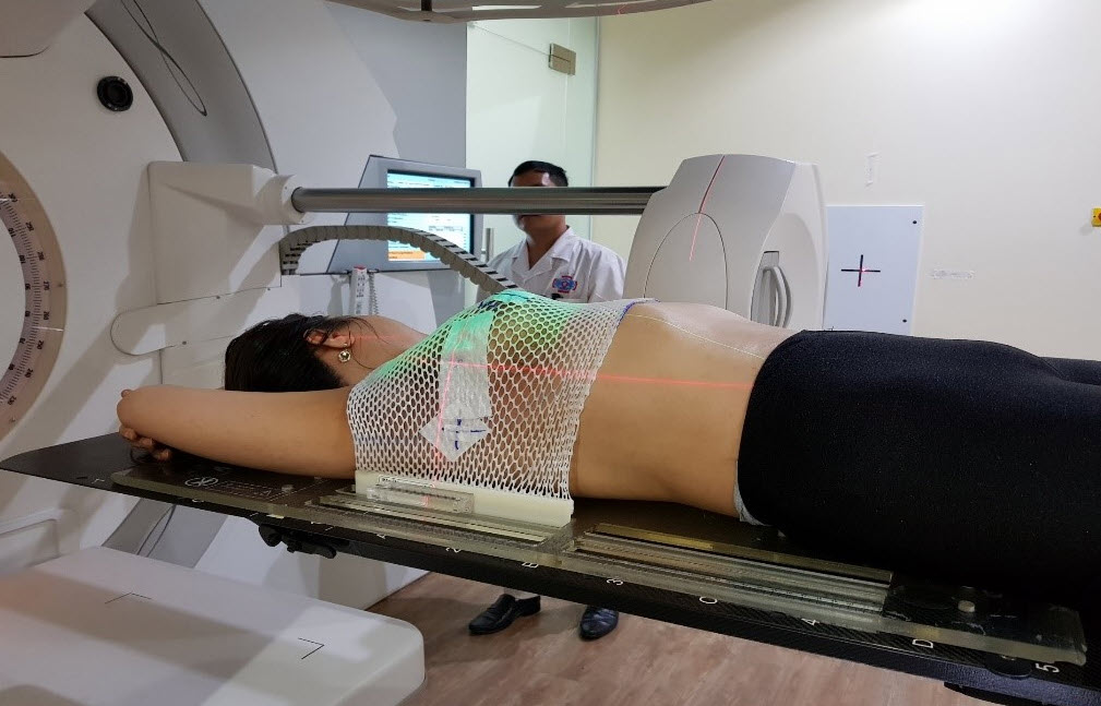 Hình ảnh xạ trị vùng ngực – một trong những liệu pháp có nguy cơ gây ung thư thứ phát nếu không kiểm soát liều lượng chính xác.