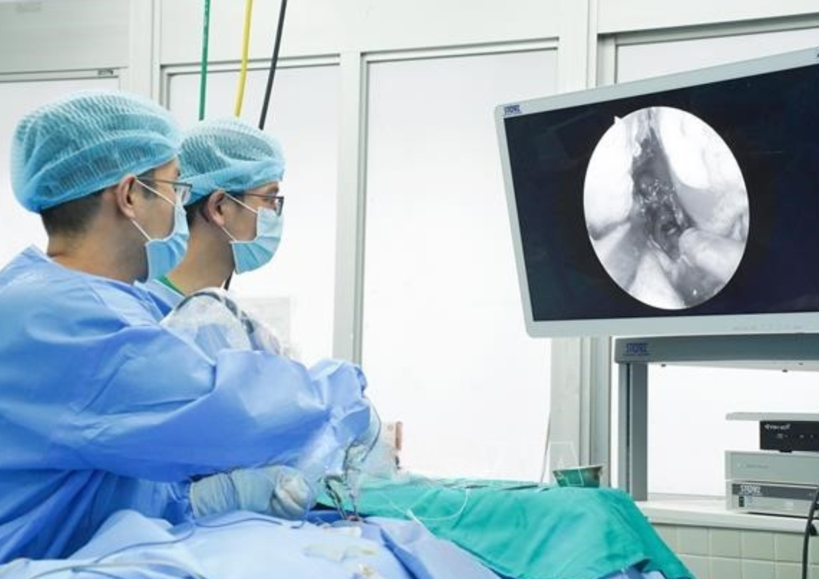 Bác sĩ Bệnh viện Chợ Rẫy thực hiện phẫu thuật lấy khối u tuyến yên khổng lồ cho bệnh nhân bằng Hệ thống phẫu thuật nội soi thần kinh hiện đại.