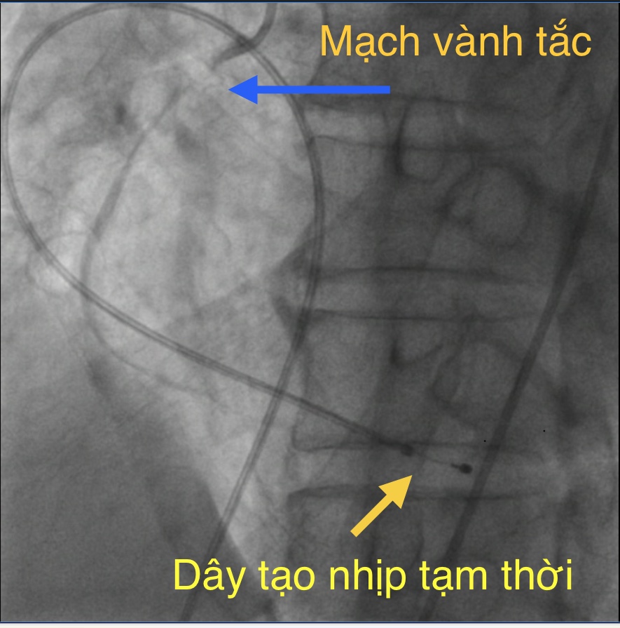 Hình ảnh do bệnh viện cung cấp.