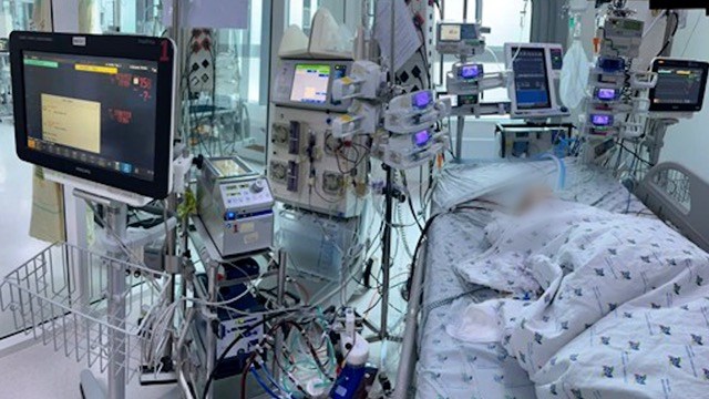 Bệnh nhi mắc tay chân miệng độ 4 được điều trị tích cực. Ảnh: BVCC