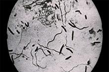 Vi khuẩn hóa 'xác sống' để ẩn nấp trong cơ thể người