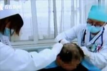 Người đàn ông Trung Quốc bị ngộ độc nặng vì nhầm thuốc trừ sâu thành dầu gội đầu