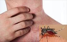 Bộ Y tế khuyến cáo phòng ngừa bệnh sốt xuất huyết ngay tại nhà