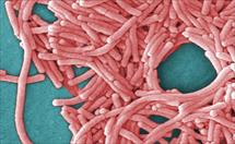 Bệnh viêm phổi do nhiễm vi khuẩn Legionella