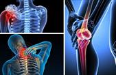 6 loại thực phẩm nên tránh khi bị viêm khớp