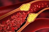 Cholesterol cao có thể gây ra rối loạn cương dương?