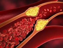 Cholesterol cao có thể gây ra rối loạn cương dương?