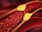 Cholesterol cao có thể gây ra rối loạn cương dương?