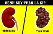 Lọc máu cấp cứu bệnh nhân suy thận nặng do tự ý dùng thuốc nam