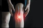 Các thuốc có thể giúp giảm đau đầu gối