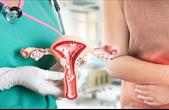 5 dấu hiệu nghi ngờ ung thư cổ tử cung chị em cần biết