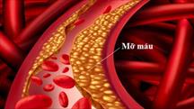 Rối loạn lipid máu ở bệnh nhân tiểu đường cần lưu ý gì?