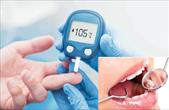Dấu hiệu cảnh báo mắc bệnh răng miệng ở người tiểu đường