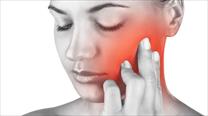 Đau đột ngột như dao đâm vùng hàm mặt cảnh giác với đau dây thần kinh số 5