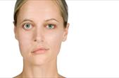 Nhận biết nhược cơ và biến chứng nguy hiểm