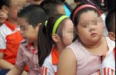 Nghịch lý dinh dưỡng học đường: Trẻ suy dinh dưỡng và béo phì cùng tồn tại trong một lớp học