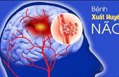 Nguyên nhân gây xuất huyết não