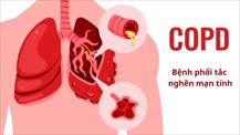 Chuyên gia khuyến nghị gì về COPD - căn bệnh là nguyên nhân tử vong thứ ba?