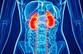 Đau lưng kéo dài, người đàn ông 60 tuổi phát hiện ung thư thận hiếm gặp