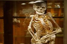Người phụ nữ hóa đá hiến xương cho bảo tàng Mỹ