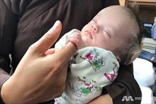 Em bé bị treo trên cây ở Việt Nam hồi phục kỳ diệu ở Bệnh viện Singapore