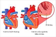 Điều tra dịch tễ sau thông tin 'virus lạ gây tử vong nhanh'