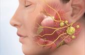 Viêm tuyến nước bọt mang tai có nguy hiểm không?