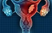 Nhiễm virus HPV có nhất thiết phải tầm soát ung thư cổ tử cung?