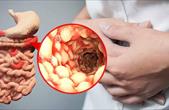 Bệnh Crohn có biểu hiện và những hệ lụy gì?