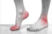 5 loại rau củ tốt cho bệnh gout và cách chế biến có lợi nhất