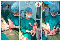 Tuyên Quang: Thêm một ca sinh tam thai cùng trứng từ người mẹ mang thai tự nhiên