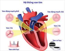 Phẫu thuật van tim: Những điều cần biết