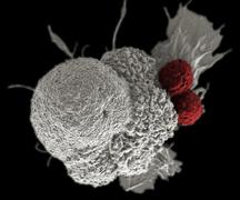 Tin vui: tìm ra chất làm thuốc trị ung thư mới khiến tế bào ung thư ‘chết đói‘