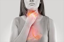 3 điều cầu lưu ý trong bệnh trào ngược họng thanh quản