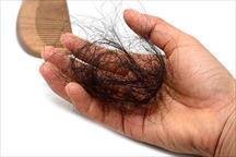 Đông y khắc phục chứng rụng tóc như thế nào?